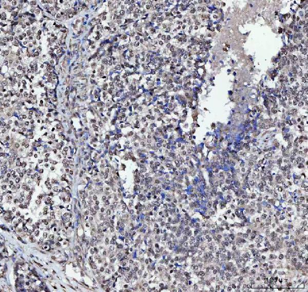 a08522 plekhg5 primary antibodies ihc testing 7