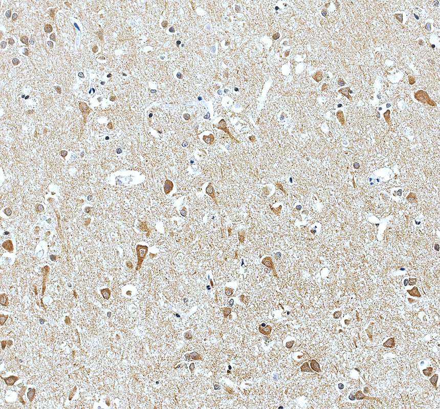 IHC analysis of LARP6 using anti-LARP6 antibody (A08524-1)