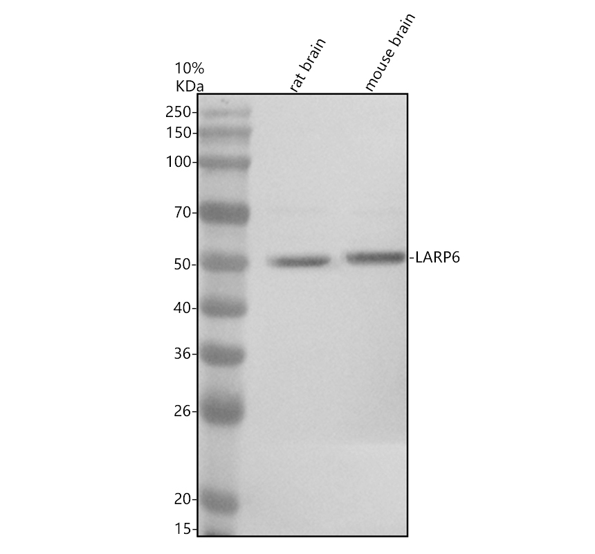 Western blot analysis of LARP6 using anti-LARP6 antibody (A08524-1)