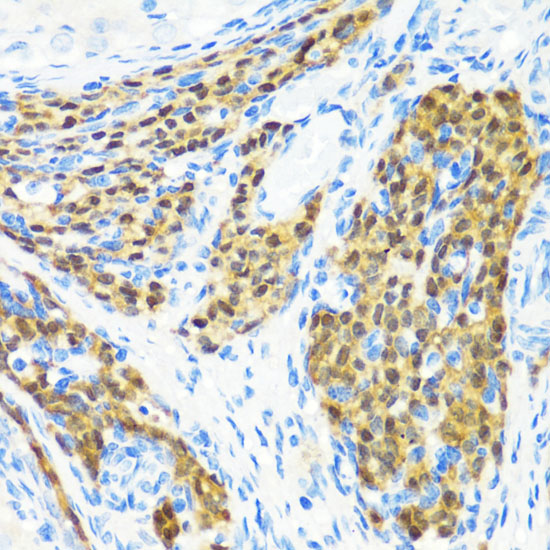 a08526 kmt2e primary antiboties ihc testing 2