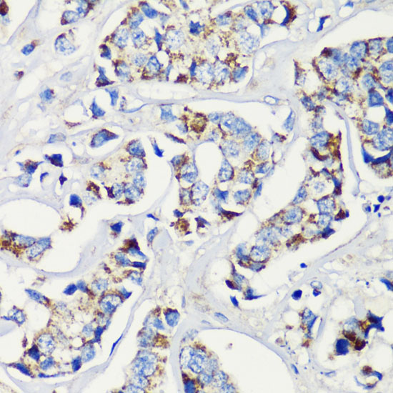 a08526 kmt2e primary antiboties ihc testing 3