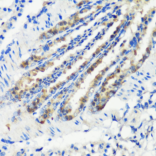 a08526 kmt2e primary antiboties ihc testing 4
