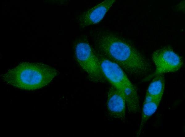 a08527 1 ap2a2 primary antibodies if testing 6