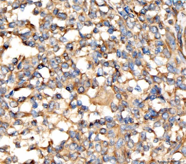  IHC analysis of AP2A2 using anti-AP2A2 antibody (A08527-1)
