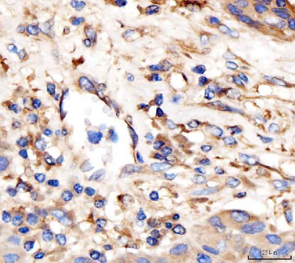 a08527 1 ap2a2 primary antibodies ihc testing 4
