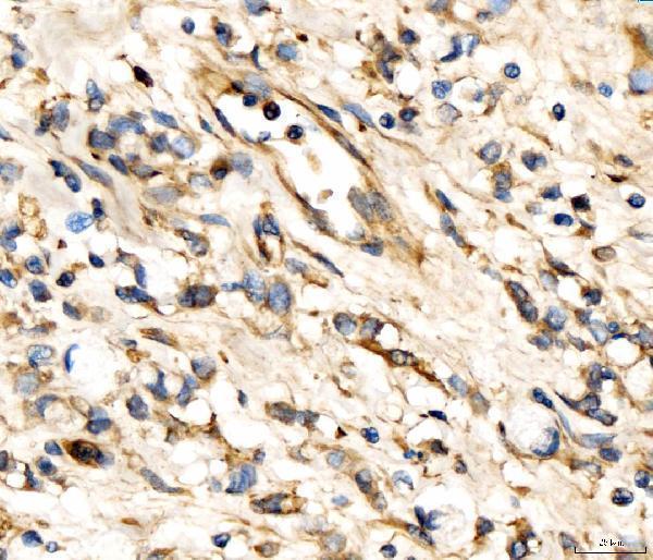 a08527 1 ap2a2 primary antibodies ihc testing 5