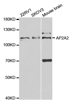 a08527 ap2a2 primary antiboties wb testing 1