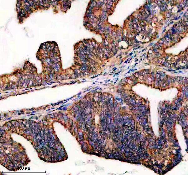 IHC analysis of EEF1E1 using anti-EEF1E1 antibody (A08532-4)