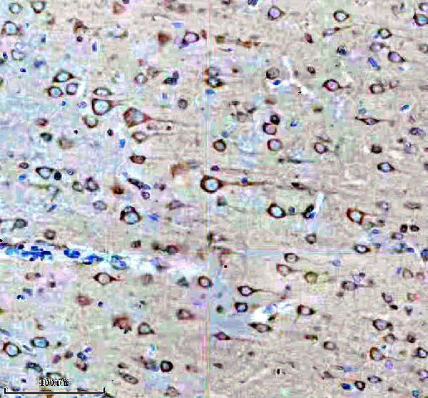 IHC analysis of EEF1E1 using anti-EEF1E1 antibody (A08532-4)