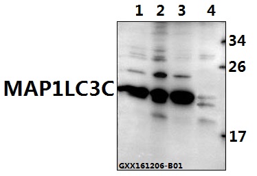 Western blot (WB) analysis of MAP1LC3C (P77) polyclonal antibody at 1:500 dilution
Lane1:C6 whole cell lysate(40ug)
Lane2:AML-12 whole cell lysate(40ug)
Lane3:L02 whole cell lysate(40ug)
Lane4:HEK293T whole cell lysate(40ug)