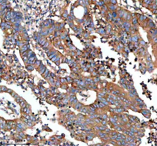 IHC analysis of MAP1LC3C using anti-MAP1LC3C antibody (A08533-2)