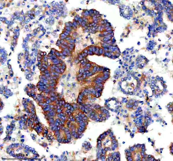 IHC analysis of MAP1LC3C using anti-MAP1LC3C antibody (A08533-2)