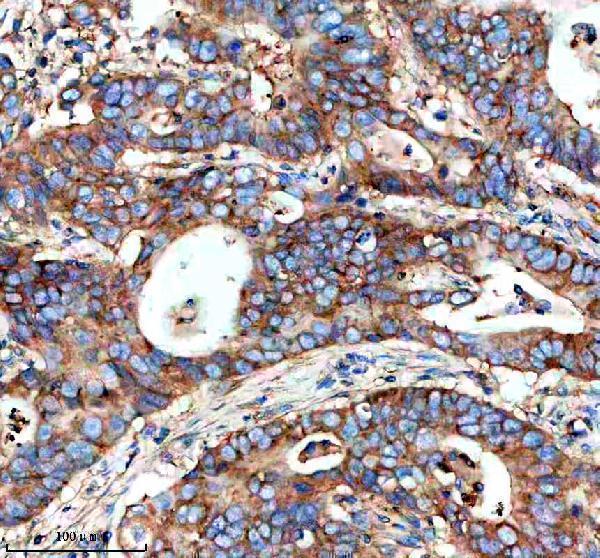 a08533 2 map1lc3c primary antibodies ihc testing 4