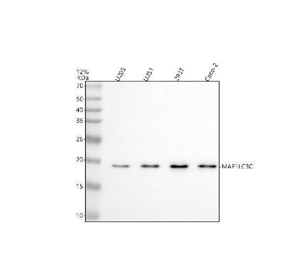 Western blot analysis of MAP1LC3C using anti-MAP1LC3C antibody (A08533-2)
