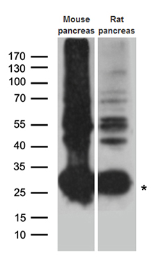 a08534 anti chymotrypsin like protease ctrl rabbit polyclonal antibody wb testing 2