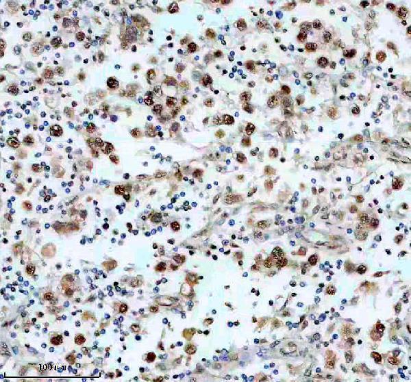 a08536 drap1 primary antibodies ihc testing 2