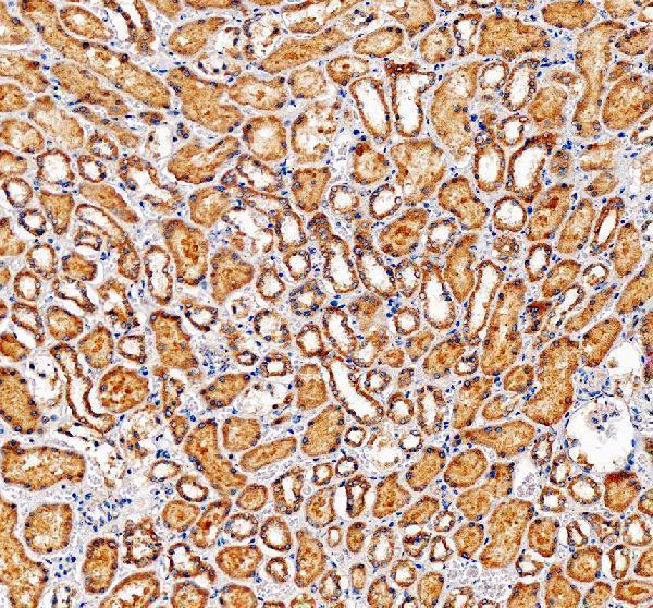 IHC analysis of NUBP1 using anti-NUBP1 antibody (A08538-1)