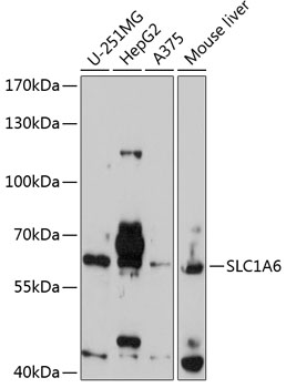 a08539 slc1a6 primary antiboties wb testing 1