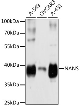 Western blot analysis of extracts of various cell lines, using NANS antibody  at 1:3000 dilution