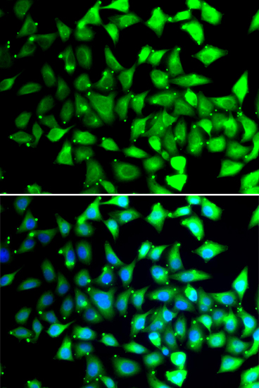 a08543 1 cops6 primary antiboties if testing 2