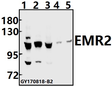 Western blot (WB) analysis of EMR2 (L160) pAb at 1:500 dilution
Lane1:K562 whole cell lysate(40ug)
Lane2:U-87MG whole cell lysate(40ug)
Lane3:A549 whole cell lysate(40ug)
Lane4:The Lung tissue lysate of Mouse(40ug)
Lane5:The Lung tissue lysate of Rat(40ug)