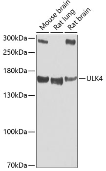 Western blot analysis of extracts of various cell lines, using ULK4 antibody