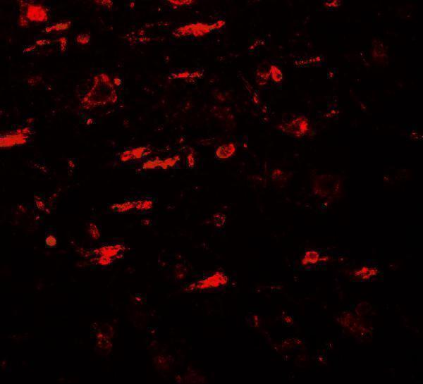 a08552 ulk4 primary antibodies if testing 3