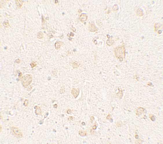 a08552 ulk4 primary antibodies ihc testing 2