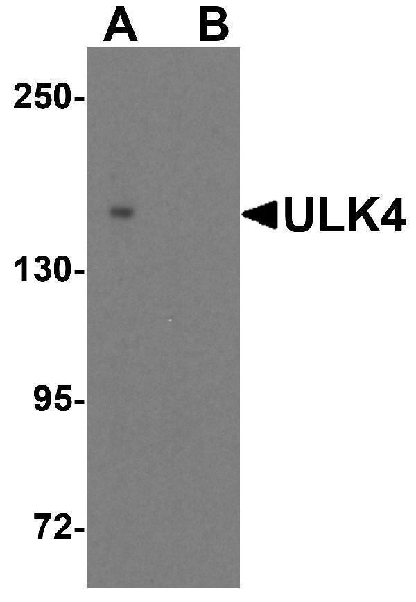 a08552 ulk4 primary antibodies wb testing 1
