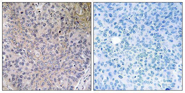 a08554 ndufs7 primary antibodies ihc testing 1