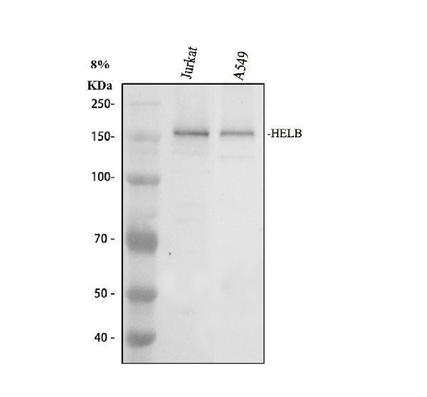 a08560 1 helb primary antibodies wb testing 1