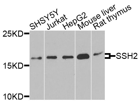 a08561 ssh2 primary antiboties wb testing 1