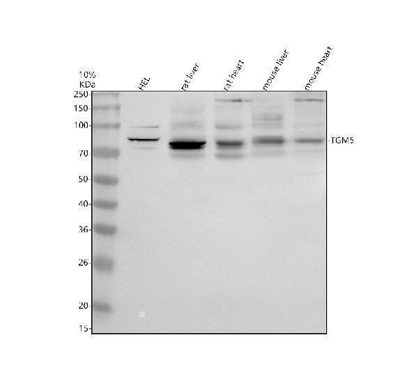 Western blot analysis of TGM5 using anti-TGM5 antibody (A08563-1)