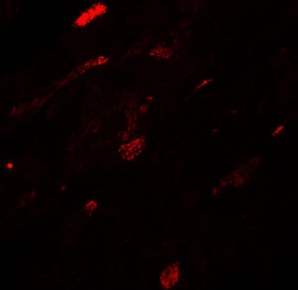 Immunofluorescence of TGM5 in mouse heart tissue with TGM5 antibody at 20 μg/mL