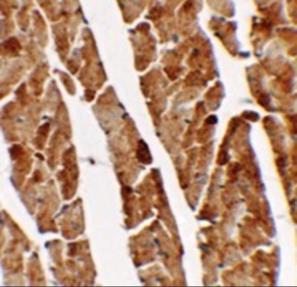 Immunohistochemistry of TGM5 in mouse heart tissue with TGM5 antibody at 2