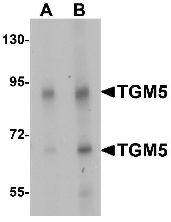 Western blot analysis of TGM5 in rat heart tissue lysate with TGM5 antibody at (A) 1 and (B) 2 μg/mL