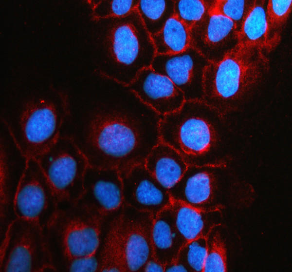a08564 slc15a2 primary antibodies if testing 1