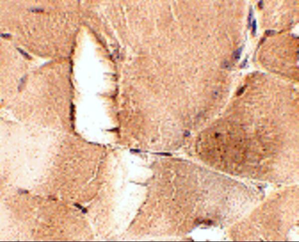 Immunohistochemistry of JPH1 in mouse skeletal muscle tissue with JPH1 antibody at 2