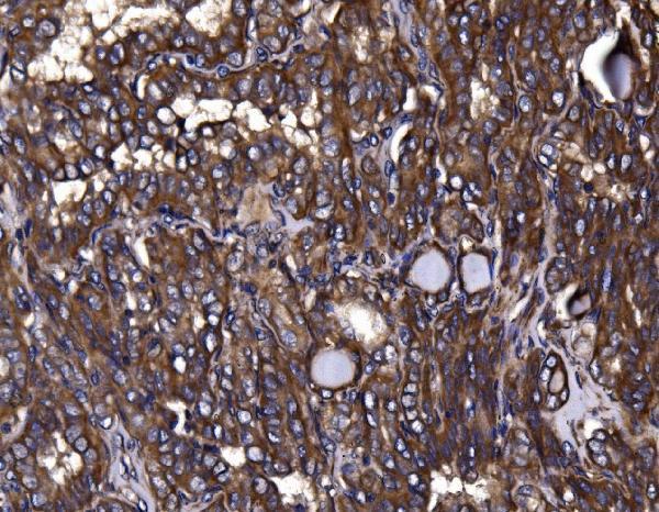  IHC analysis of KLHL12 using anti-KLHL12 antibody (A08568-2)
