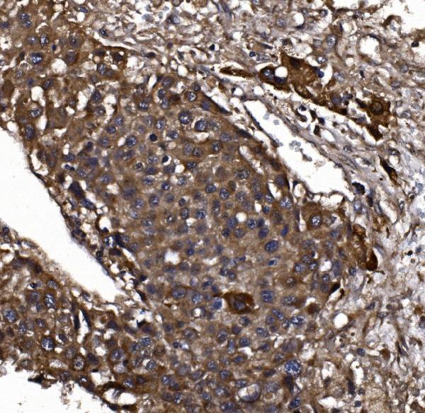  IHC analysis of KLHL12 using anti-KLHL12 antibody (A08568-2)