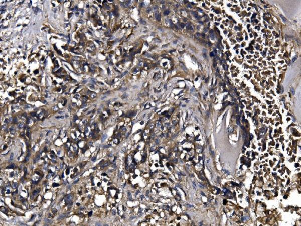 a08568 2 klhl12 primary antibodies ihc testing 4