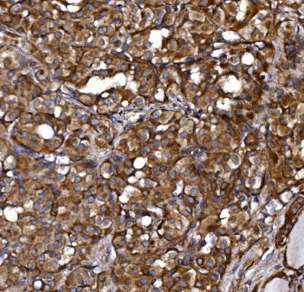 a08568 2 klhl12 primary antibodies ihc testing 5