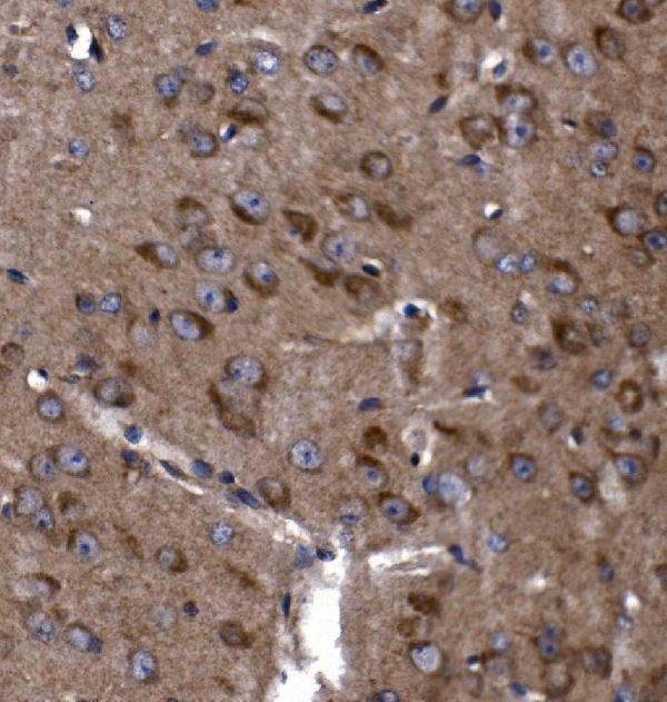 a08568 2 klhl12 primary antibodies ihc testing 6