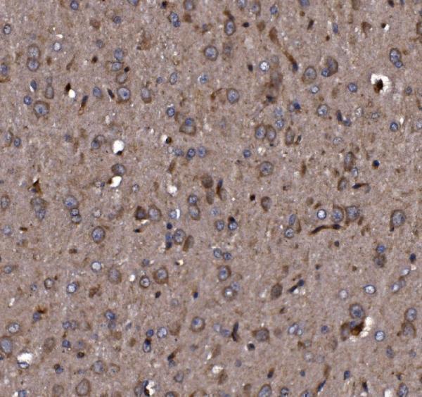 a08568 2 klhl12 primary antibodies ihc testing 7