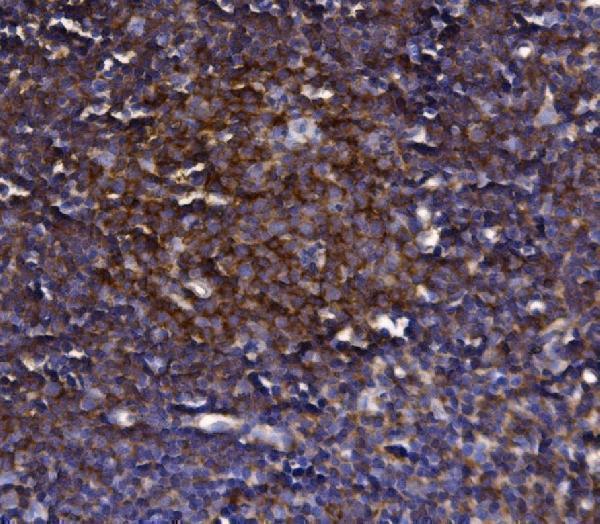 a08568 2 klhl12 primary antibodies ihc testing 8