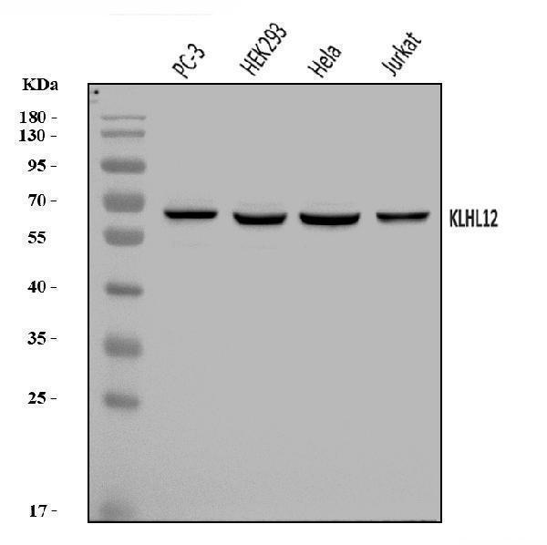  Western blot analysis of KLHL12 using anti-KLHL12 antibody (A08568-2)