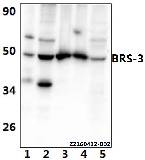 Western blot (WB) analysis of BRS-3 (E201) polyclonal antibody at 1:500 dilution
Lane1:Jurkat whole cell lysate(40ug)
Lane2:A549 whole cell lysate(40ug)
Lane3:The testis tissue lysate of Mouse(40ug)
Lane4:The testis tissue lysate of Rat(40ug)
Lane5:HEK293T whole cell lysate(40ug)