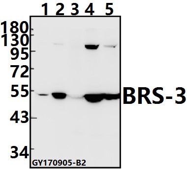 Western blot (WB) analysis of BRS-3 (C203) pAb at 1:500 dilution
Lane1:A549 whole cell lysate(10ug)
Lane2:Panc1 whole cell lysate(10ug)
Lane3:BV2 whole cell lysate(40ug)
Lane4:H9C2 whole cell lysate(40ug)
Lane5:PC12 whole cell lysate(40ug)