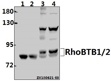 Western blot (WB) analysis of RhoBTB1/2 (T85) pAb at 1:1000 dilution
Lane1:The Kidney tissue lysate of Mouse(40ug)
Lane2:The Kidney tissue lysate of Rat(40ug)
Lane3:U-87MG whole cell lysate(40ug)
Lane4:Hela whole cell lysate(40ug)