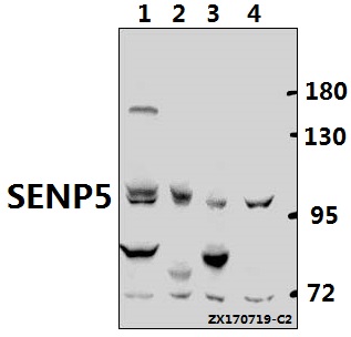 Western blot (WB) analysis of SENP5 (L681) pAb at 1:500 dilution
Lane1:PC3 whole cell lysate(40ug)
Lane2:MCF-7 whole cell lysate(40ug)
Lane3:C6 whole cell lysate(40ug)
Lane4:MEF whole cell lysate(40ug)